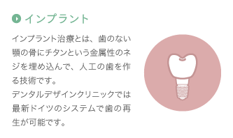 インプラント：インプラント治療とは、歯のない顎の骨にチタンという金属性のネジを埋め込んで、人工の歯を作る技術です。デンタルデザインクリニックでは最新ドイツのシステムで歯の再生が可能です。