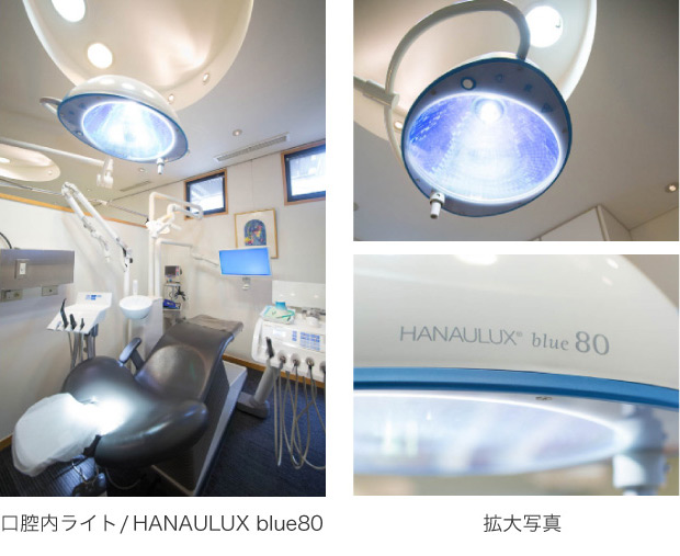 口腔内ライト/HANAULUX blue80